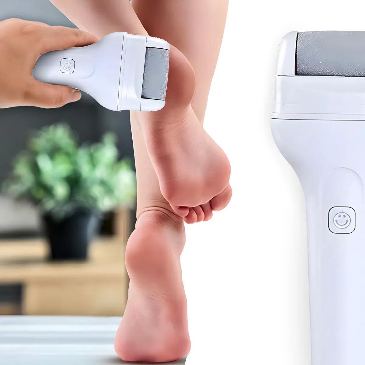 Pedicure Pro 360 - Lixador Para os Pés